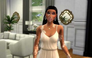 Arriva la pelle con la vitiligine in The Sims 4 in collaborazione con Winnie Harlow